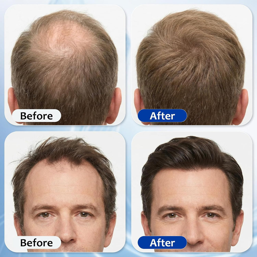Hair Growth Serum Roll On with 3% Rosemary,3% Batana Oil,2% Pea Extract,2% Ginger Root Oil,Stronger Root,stimulate follicle,Hair Thicker,Hair Loss Treatment,Hair Growth Serum(30ML/1.01FL.OZ)