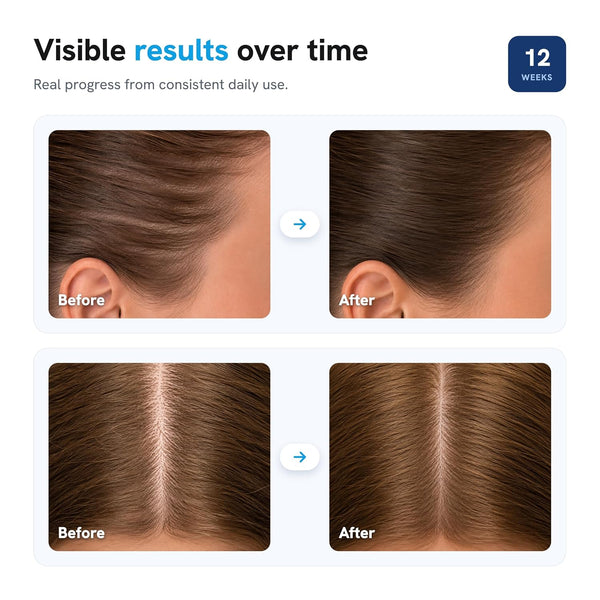 Revive & Thrive Hair Roll-On