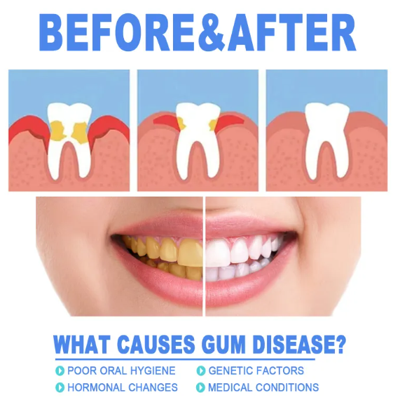 Gel	The Restore — Advanced Teeth Repair Gel